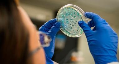 exames microbiologicos varginha labsul mg 1